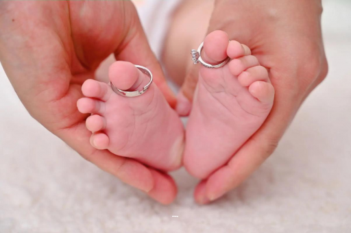 广元孕妇怎样预防妊娠纹